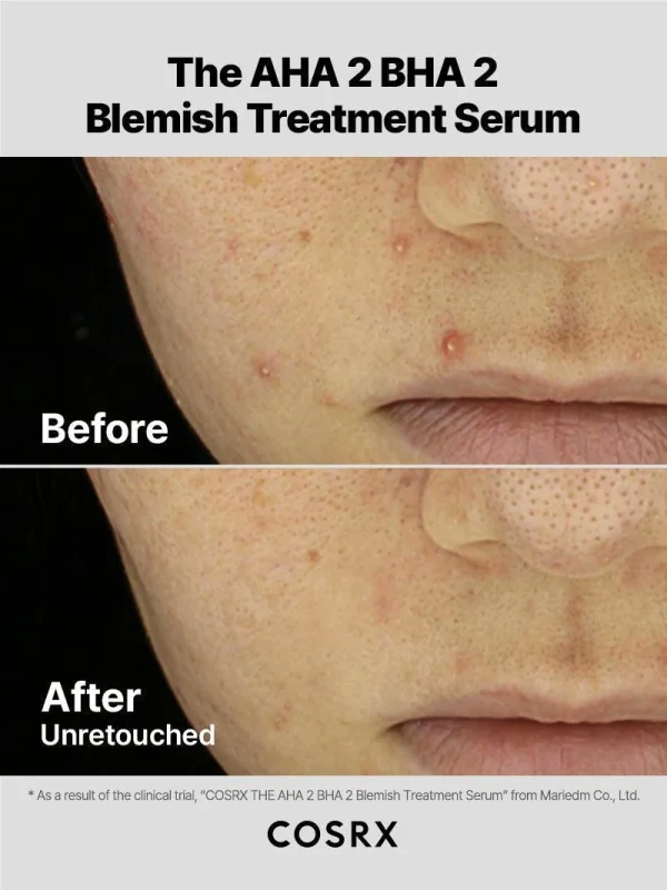 cosrx-the-aha-2-bha-2-blemish-treatment-50ml30-cotton-balls-pic-6