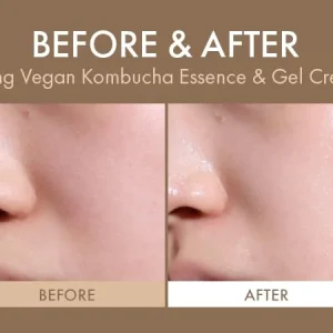 dr-ceuracle-vegan-kombucha-tea-gel-cream-75g-pic-3