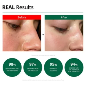 drg-red-blemish-clear-soothing-cream-70ml-pic-6