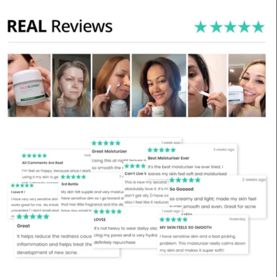 drg-red-blemish-clear-soothing-cream-70ml-pic-7
