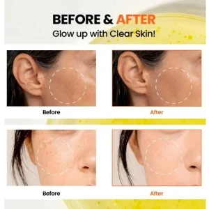 ksecret-seoul-1988-glow-serum-niacinamide-15percent-yuja-30ml-pic-3