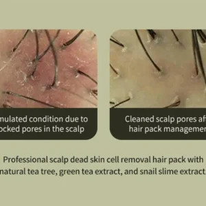 lador-tea-tree-scalp-clinic-hair-pack-200ml-pic-3