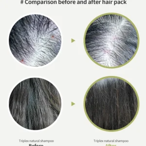lador-tea-tree-scalp-clinic-hair-pack-200ml-pic-7