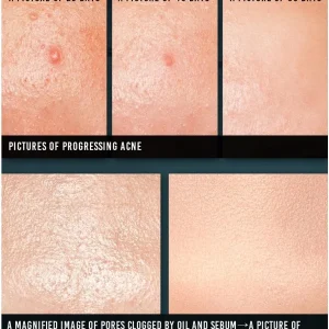 pyunkang-yul-acne-cream-50ml-pic-5