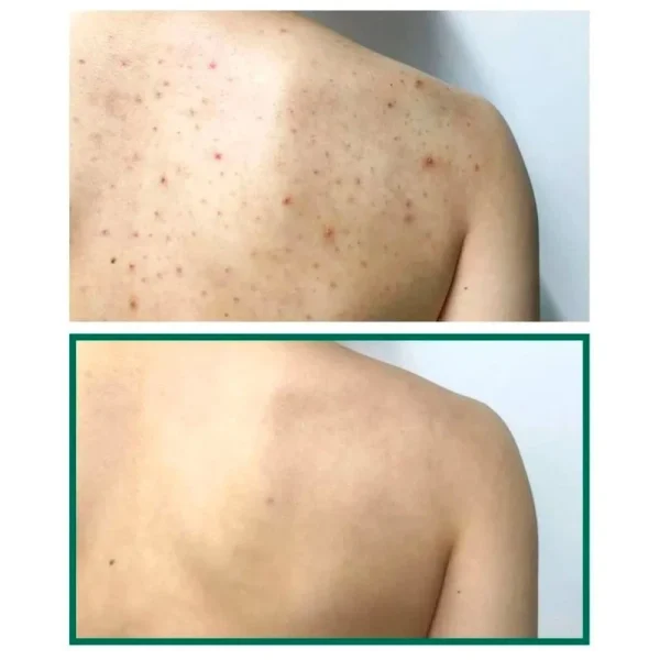 some-by-mi-aha-bha-pha-30-days-miracle-acne-clear-body-cleanser-400ml-pic-8