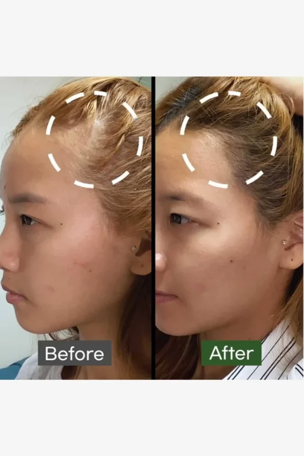 some-by-mi-cica-peptide-anti-hair-loss-derma-scalp-treatment-50ml-pic-4