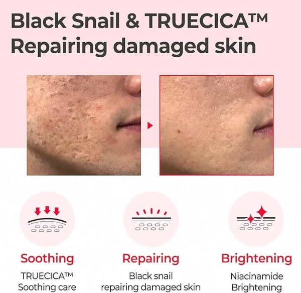 some-by-mi-snail-truecica-miracle-repair-toner-150ml-pic-4