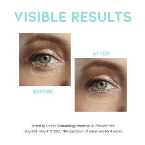 ootd-wrinkle-lift-eye-serum-30g-pic-4