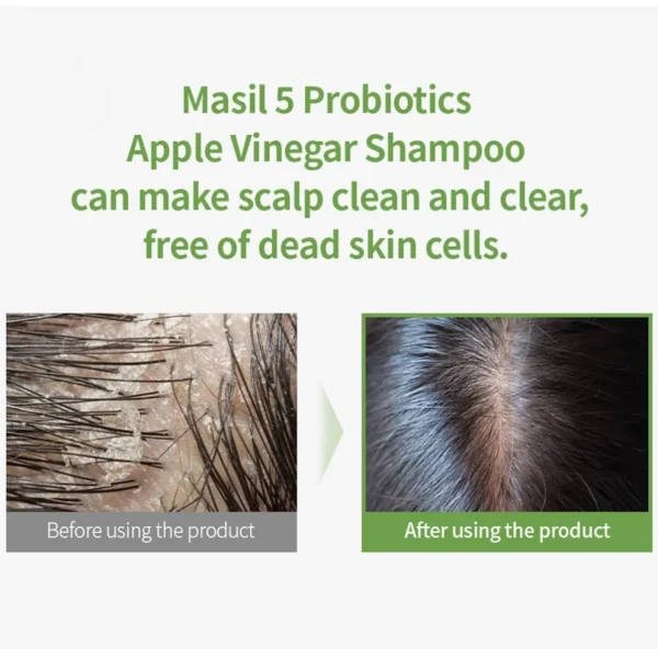 masil-5-probiotics-apple-vinegar-shampoo-stick-pouch-pic-2