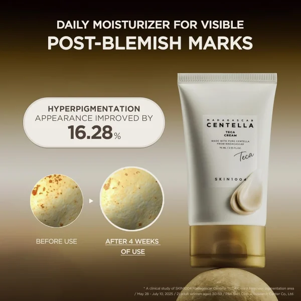 skin1004-madagascar-centella-teca-cream-75ml-pic-4